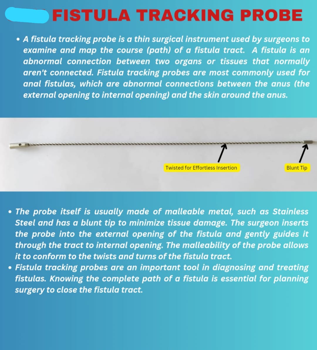 Fistula Tracking Prob