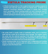 Fistula Tracking Prob