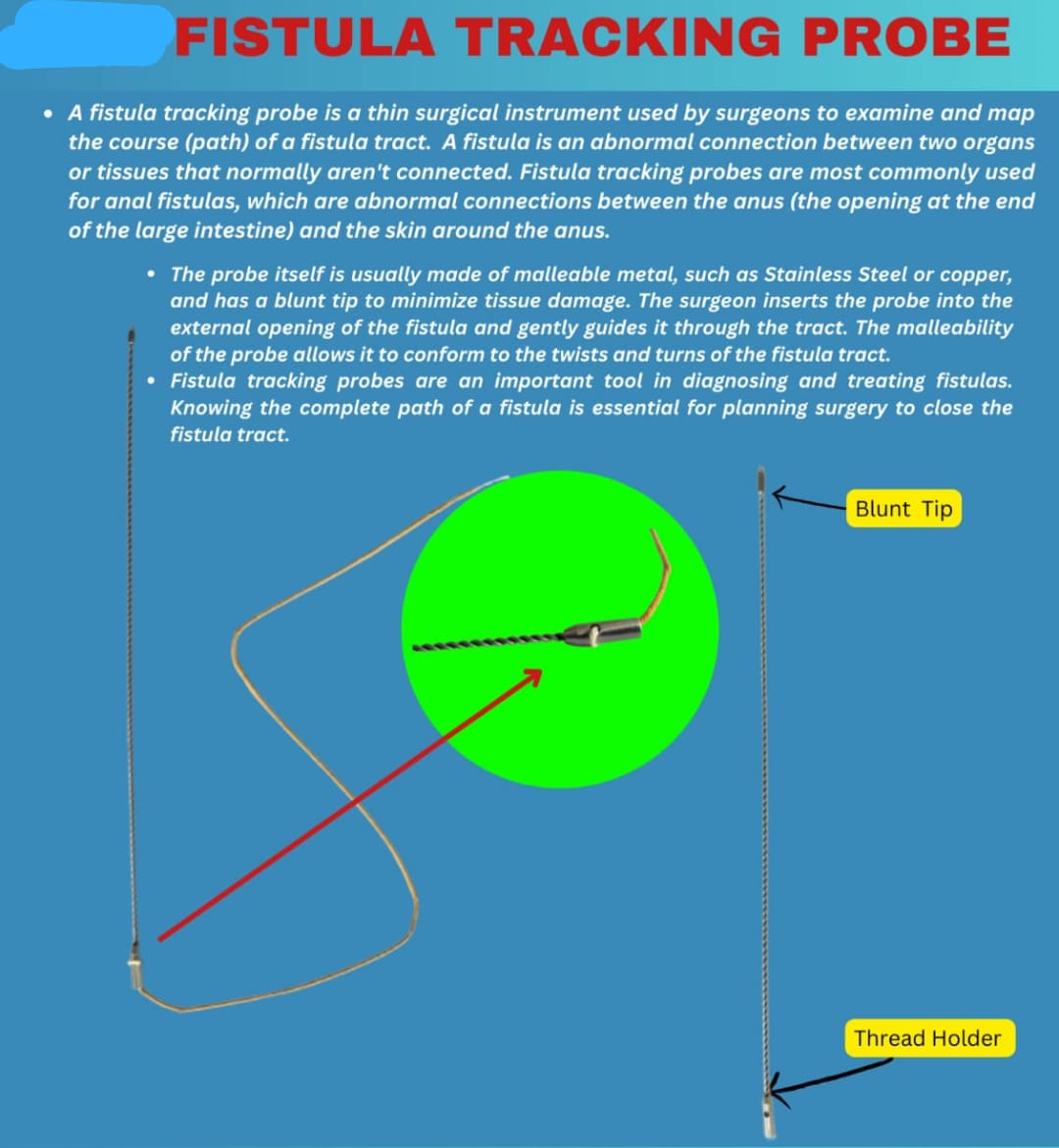 Fistula Tracking Prob