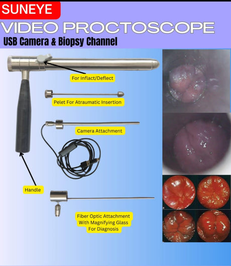 SUNEYE Video Proctoscope SS