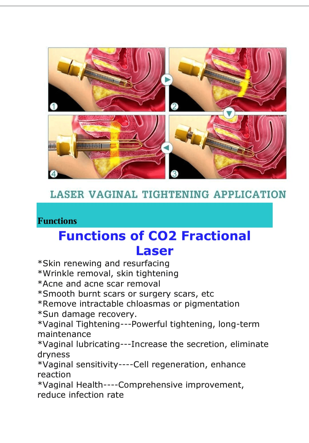 CO₂ Fractional Laser Machine