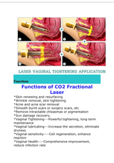CO₂ Fractional Laser Machine