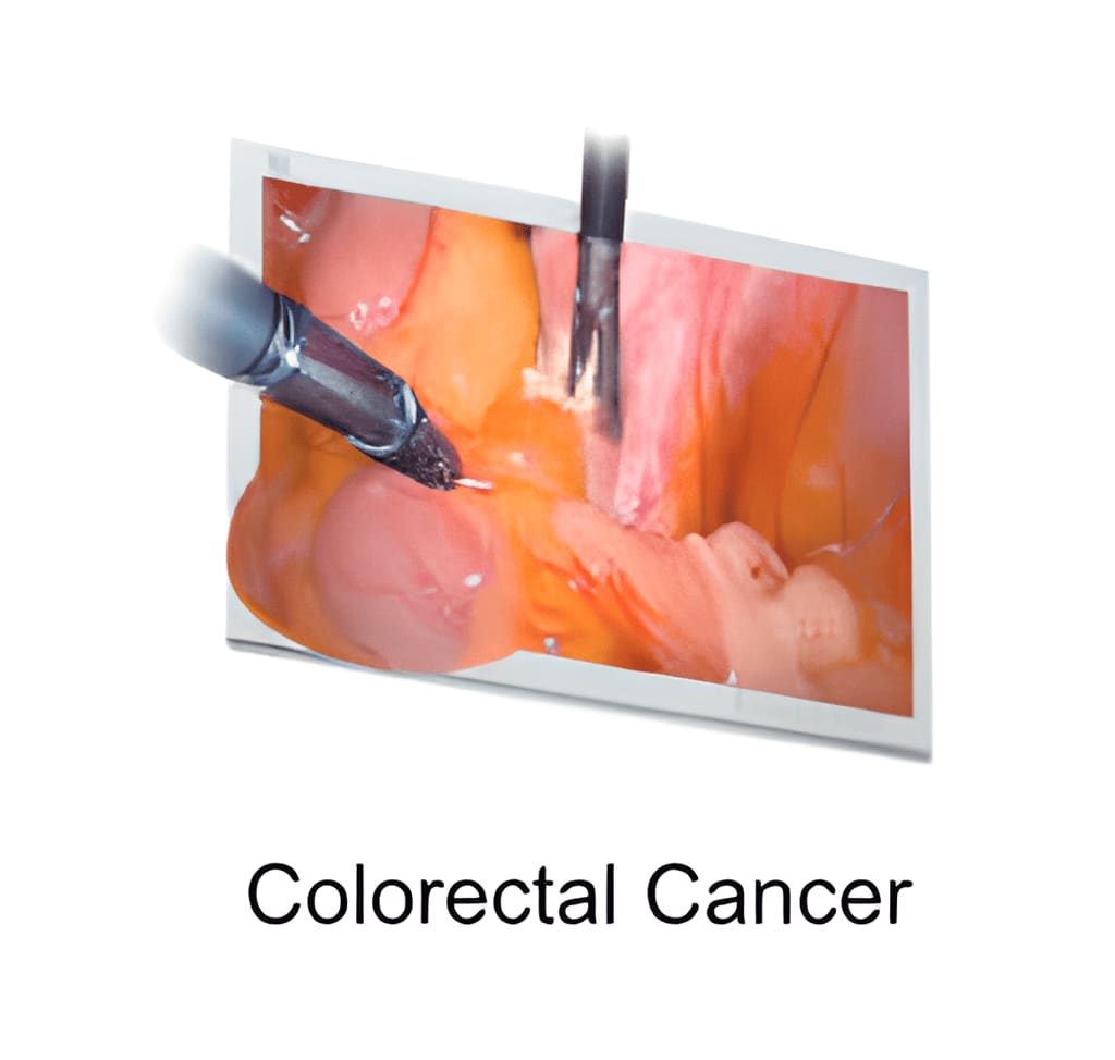 Endoscopic Camera System DSC-103E Pro for Laparoscopy & Endososcopy