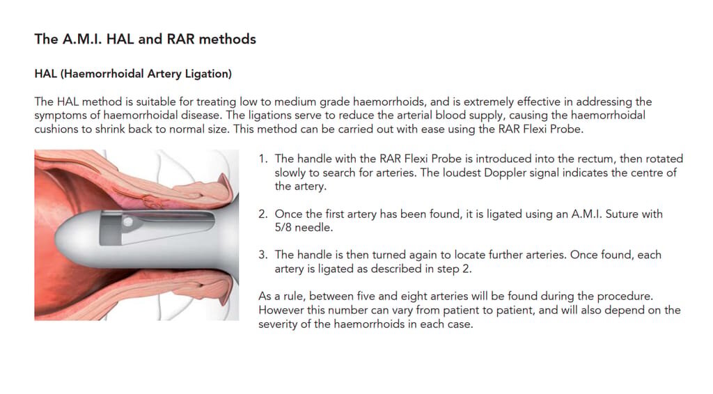 A.M.I.® HAL / RAR System