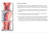 HAL - RAR Trilogy (Doppler Guided Artery Ligation for Haemorrhoids)
